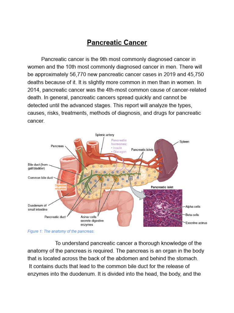 Pancreatic Cancer | PDF