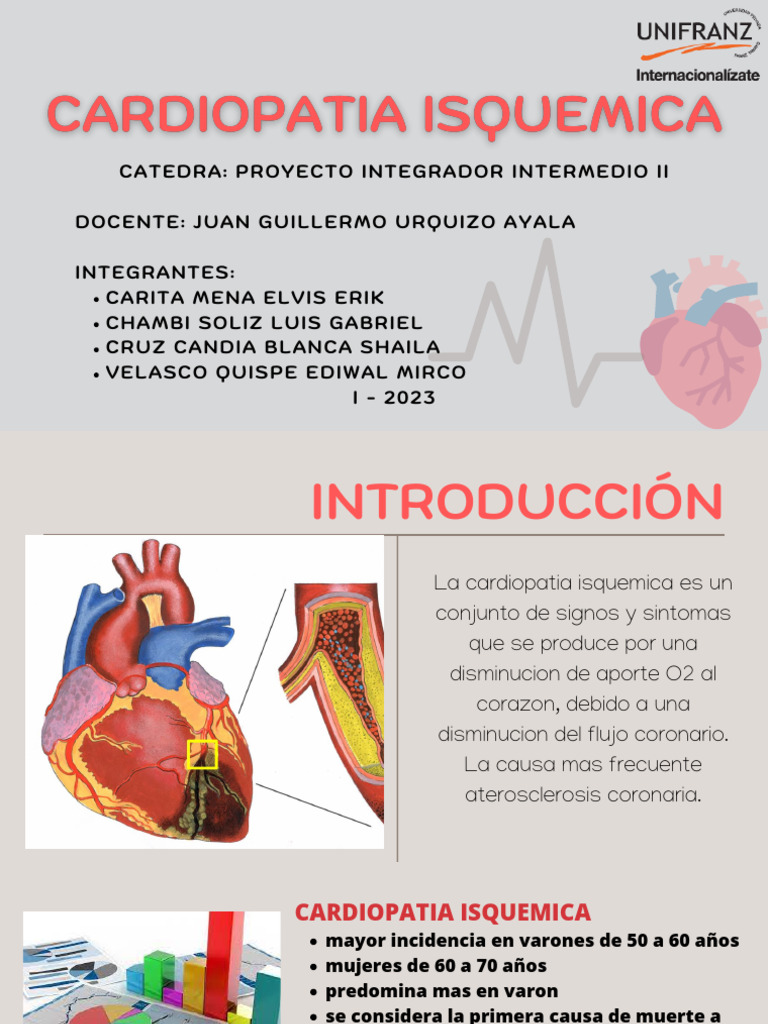 Cardiopatia Isquemica | PDF | Electrocardiografia | Infarto de miocardio