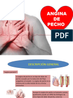  Angina de Pechoo