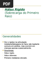 Hálux Rígido