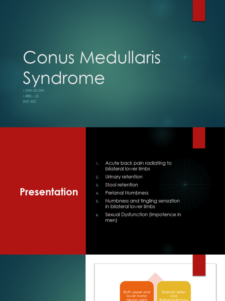 The Conus Medullaris Syndrome: A Critical Review of the Anatomy, Symptoms, and Treatment Options