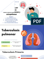 Tuberculosis