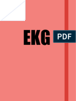 Ekg