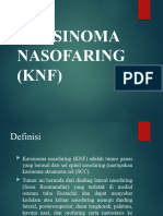 Neoplasma Nasofaring (KNF)
