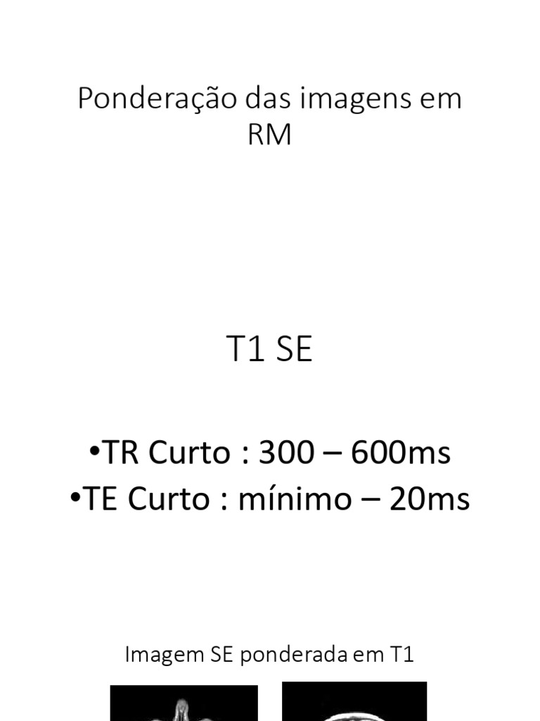 Ponderações em Ressonância Magnética | PDF