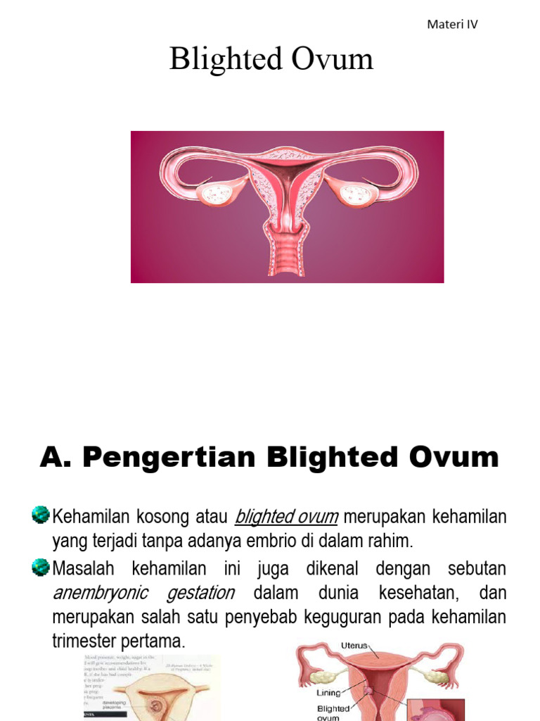Blighted Ovum | PDF