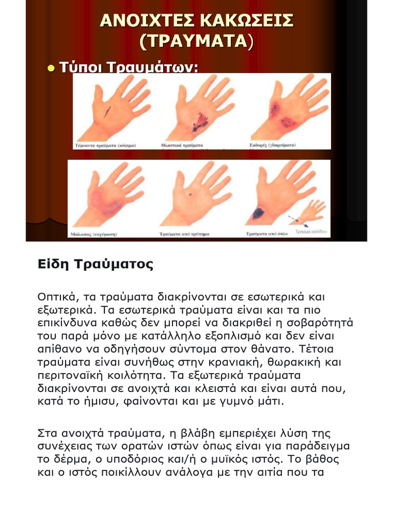 Trauma | PDF