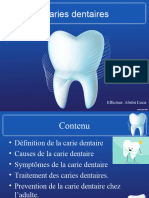 Caries Dentaires