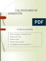 Clinical Features of Gingivitis