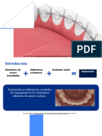 Retenedores Fijos