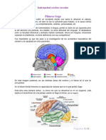 Phineas Gage: Enfermedad Cerebro Vascular