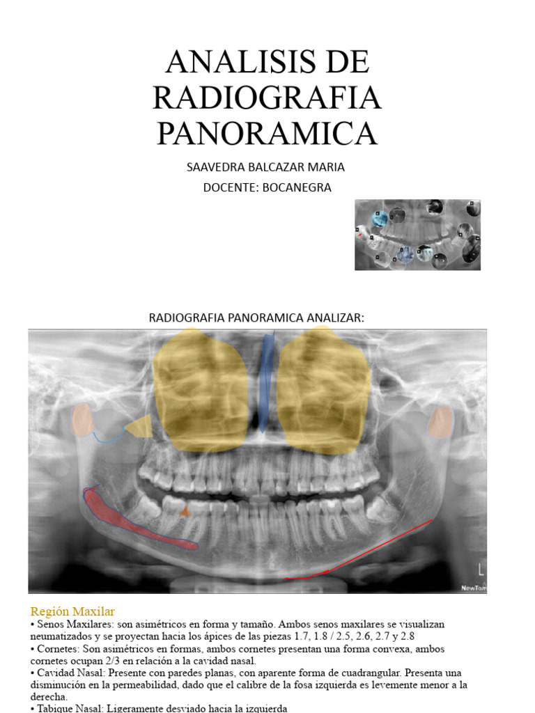 Análisis de Radiografía Panorámica | PDF