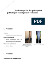 6 Semiologie Chirurgicale Vasculaire Varices