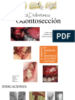 Odontoseccion