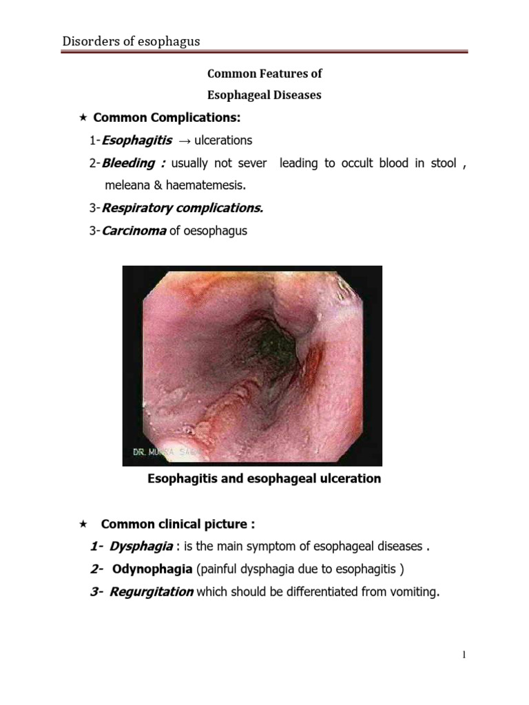 Common Features of Diseases of Esophagus | PDF | Esophagus | Vomiting