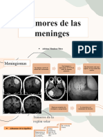 Tumores de Las Meninges 1