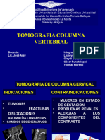 Tomografia Columna Vertebral.