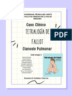 Tetralogia de Fallot Con Estenosis Pulmonar