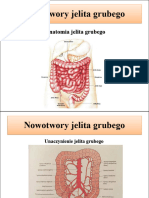 Nowotwory Jelita Grubego