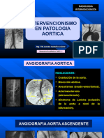 Intervencionismo en Patologia Aortica