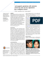 A Huge Oral Pyogenic Granuloma With Extensive