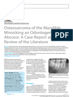 Osteosarcoma of The Mandible Mimicking An Odontogenic Abscess A Case Report and Review of The Literature