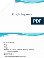 Ectopic P Regnancy Case Presentation