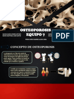 Osteoporosis Nuevo