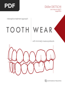 Tooth Wear