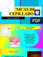 Técnicas de Cepillado