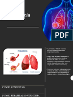 Pneumonia - Fisioterapia