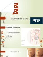 Mastectomia Radical