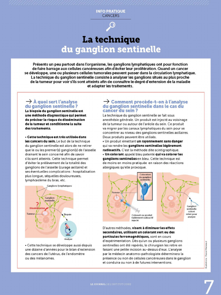 La Technique Du Ganglion Sentinelle | PDF