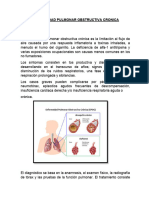 Enfermedad Pulmonar Obstructiva Cronica