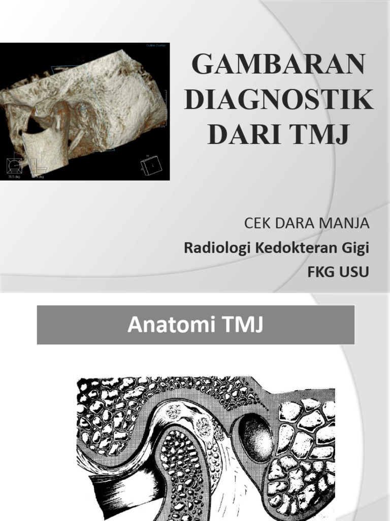 Radiologi TMJ: Teknik dan Diagnostik | PDF | Medical Imaging | Causes ...