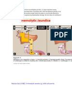Hemolytic Jaundice