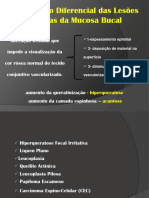 Diagnóstico Diferencial Das Lesões Brancas Da Mucosa Bucal