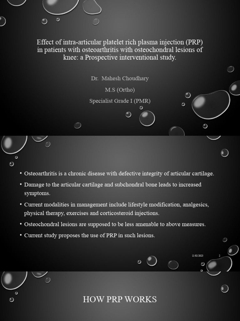 PRP Injections for Knee Osteoarthritis | PDF | Osteoarthritis ...