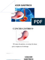 Cáncer Gástrico