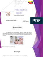 Bronquiolitis