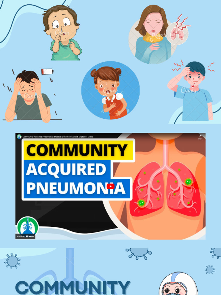 Community Acquired Pneumonia | PDF