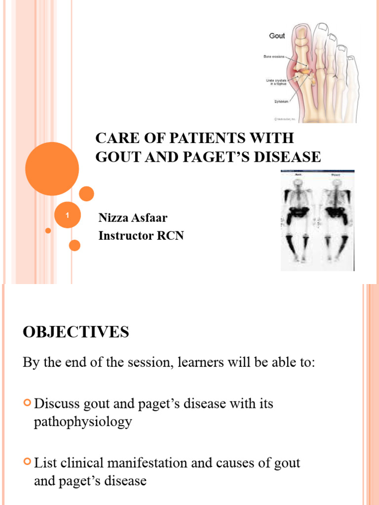 Lect # 2 Care of Patients With Gout and Paget's Disease | PDF | Gout | Bone