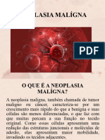 NEOPLASIA MALÍGNA Atualizado