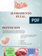 Sufrimiento Fetal Expo