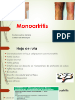 Monoartritis