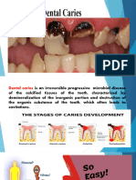1 - Theories of Dental Caries