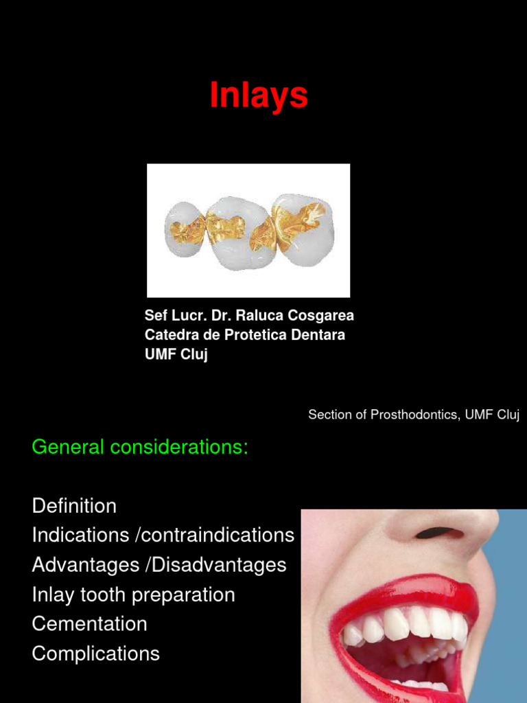 Inlays: Indications and Preparation Guide | PDF | Dentistry | Tooth