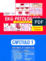 Ecg Patologico