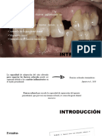 Ajuste Oclusal y Ferulizacion