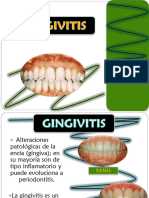 Clase 12 de Gingivitisss